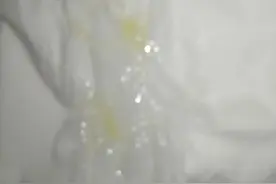 儿童感冒后黄鼻涕，需要口服抗生素吗？图片