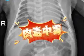 52天婴儿喝奶奶喂的蜂蜜水后中毒进ICU，医生提醒：1岁以下婴儿不宜食用蜂蜜图片