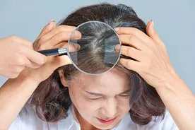 白头拔一根长十根？专家：没有科学依据图片
