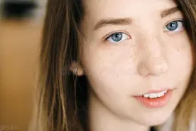 医格仕祛斑揭秘五种科学有效的方法，告别脸上色斑图片