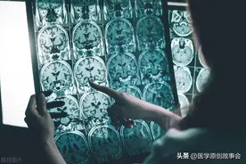 大脑开始萎缩，一般出现4个反应，多吃3种健脑食物，辅助降低风险图片