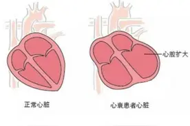 经常气短、喘不上气？别慌，这多半与5个因素有关，需对症调理！图片