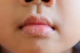 孩子咳嗽老不好，多半是肺热！1碗清肺汤，止咳化痰祛热！图片