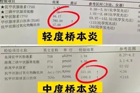 甲状腺功能3项、5项、7项、8项的临床意义!一篇文章全讲清图片