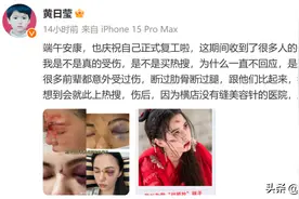 后续！知名演员成毅突发意外！吊威亚从高空摔落台阶，工作室回应图片