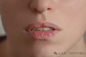 说了800遍了，冬天干燥，光喝水是不管用的！教你一个方法补救图片