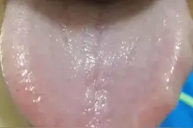 柴胡舒肝丸的3个黄金搭档！中医根据舌象，教你怎么正确运用！图片