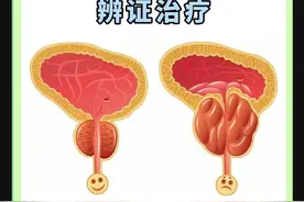 前列腺炎的6种症型及对症治疗药方图片