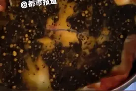 女子胆囊长上千颗结石似鱼子酱图片