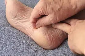 秋季脚痒痒是怎么回事图片