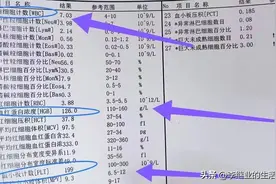 我知道的4个白血病患者，血常规都出现了“一高两低”！图片