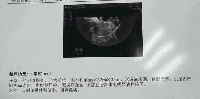 三十多岁卵巢早衰还能治好吗 2026年三十多岁卵巢早衰还能治好吗女性