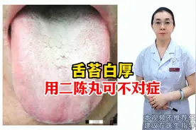看这大白舌，舌苔又白又厚，用二陈丸可不对症图片