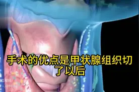 甲状腺结节手术和消融的区别图片