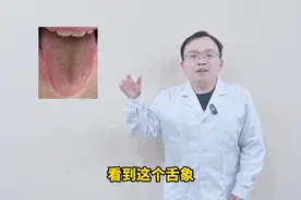 这种舌边红不是肝火旺，而是肾阴虚，当肝火治大错特错图片