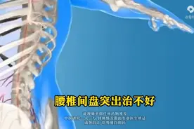 腰椎间盘突出治不好，可能是因为身体缺少这两样东西图片