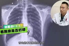 【科普】胸部DR片的观片流程（二）图片