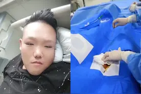 一分钟看完冠脉造影手术怎么做？图片