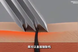 男生屁屁长毛真的“正常”吗？图片