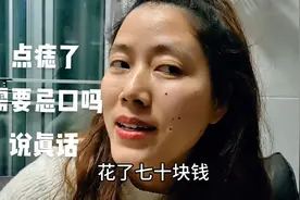 点痣了需要忌口吗？说真话？应该不会留疤吧🥹 #点痣图片