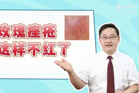 玫瑰痤疮，抗炎后真的不红了！图片