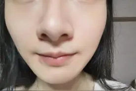 超敏感+混干性皮肤，三个月没用护肤品+洗面奶，我现在的状态图片