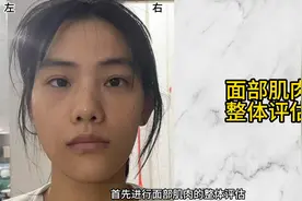 亲测有效！3个动作改善面部不对称，拯救高低眉/高低眼/...图片