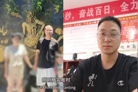 植发20多天后，我彻底秃了……#植发#脱发#米诺地尔图片
