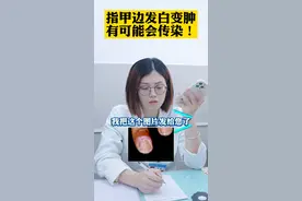 指甲变发白 变肿，有可能会传染！#医学科普 #甲沟炎  视频封面