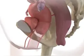 什么是脱垂、有哪些症状？视频封面