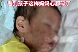 宝宝接麻腮风疫苗，家长要牢记这三点#麻腮风疫苗 #儿童疫苗视频封面