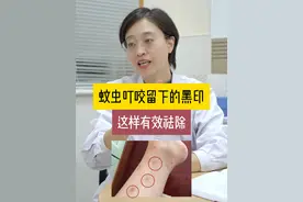 身上有#蚊虫叮咬 后黑印子很难看，可以试试这样处理！#医学科普 #涨知识 #皮肤问题 #毓医玉婷视频封面
