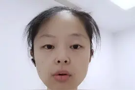 #退烧止痛布洛芬和泰诺选哪个 原则上3个月以下发热要遵医嘱，3-6个月选泰诺（对乙酰氨基酚）6个月以都可以，但建议只选一种，不建议交替使用视频封面