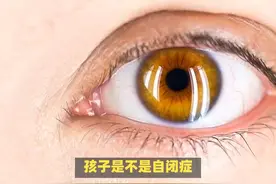 孩子是不是自闭症，人工智能看一下眼睛就确定，准确率100%视频封面