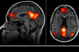 大脑里藏着一个“偷电狂魔”？ 佛家道家和科学家都在研究的秘密视频封面