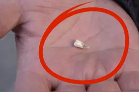 男子吃蛋筒冰淇淋，牙被硌掉？“吃到最后一口的时候牙疼”（一）#冰淇淋 #河南dou知道视频封面