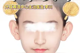 #贴面耳 矫正之后会不会变成#招风耳 ？#八大处整形医生李川 #医学科普  #精灵耳视频封面