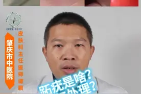 皮肤科医生和你聊聊：跖疣可以如何治疗？ 跖疣是一种常见的病毒性皮肤病，多出现在足底足趾受力部位，会有疼痛感而影响正常生活工作。今天我们来简单聊聊跖疣的防治。
#抖音知识年终大赏 #硬核健康科普行动 #跖疣 #皮肤科医生谭颖 #医学科普 @抖音短视频视频封面