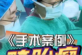 为什么畸胎瘤适合vNOTES手术进行切除 #手术室日常 #畸胎瘤 #vnotes手术 #单孔腹腔镜雷雨主任 #硬核健康科普行动视频封面