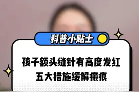 孩子额头缝针有高度发红，5大措施缓解瘢痕 孩子额头缝针有高度发红，5大措施缓解瘢痕#硬核健康科普行动 #宝宝健康攻略 #医学科普 #伤口 #瘢痕视频封面