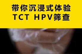 带你沉浸式体验，TCT和HPV筛查！ 1. **准备工作**
   - 使用无菌扩阴器轻柔地暴露阴道和宫颈。

2. **宫颈管细胞采样**
   - 将宫颈托举在扩阴器中，对宫颈管内的细胞进行采样。
   - 旋转采样器3-5圈后，将样本放入保存液中。

3. **宫颈表面细胞采样**
   - 使用大毛刷抵达宫颈表面，再旋转3-5圈采集脱落细胞。
   - 取出样本后，将扩阴器轻柔移除，避免患者不适。

4. **样本保存与送检**
   - 将采集的细胞样本放入含有保存液的小瓶中。
   - 送至检验科进行TCT和HPV检测。

**过程感受**
- 女性在采样过程中应保持轻松，通常不会感到不适。#hpv #女性 #tct #宫颈病变 #抖出健康知识宝藏视频封面