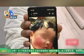 周女士租住在绍兴杨汛桥的一个村里，说是最近夜里老是被脸上的灼烧感弄醒，六个月大的女儿脸上也红扑扑的，她觉得是天花板向下有“辐射”。#1818黄金眼 #脸蛋 #辐射视频封面