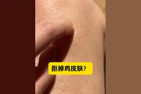 别再抠胳膊大腿疙疙瘩瘩的鸡皮肤了， 皮肤科医生教你一招低成本的处理方法。#鸡皮肤  #疙瘩  #鸡皮疙瘩  #硬核健康科普行动   #黑印视频封面