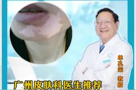 青少年白癜风治好的希望大吗? #广东白风医生推荐 #硬核健康科普行动 #单孔荣医生 #儿童白癜风 #挂单孔荣号视频封面