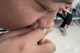 做核磁共振指甲有钢珠咋办?老公立马化身“进口”卸甲师!“我憋笑真的很辛苦”#搞笑 #老公的迷惑行为 #离谱操作 （来源@Q～ ）视频封面
