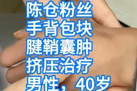 陈仓粉丝，手背包块，腱鞘囊肿，挤压治疗（男性，40岁） #视频封面