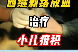 #中医 #四缝放血 #小儿疳积 #消化不良 #守护健康视频封面