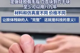 定做硅胶假手指：几百块到几千块，可以用八九年，这就是科技发展的意义吧！#假手指 #义肢 #残疾人 #手指 #意外视频封面