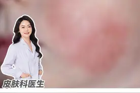宝宝常见三种皮肤病，家长要学会处理！ #硬核健康科普行动 #婴儿皮肤病 #湿疹 #荨麻疹 #剥脱性角质松解症 @抖音短视频视频封面