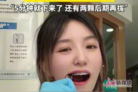 4月2日（报道）青海西宁。03年女牙医自己打麻药拔智齿，全程面不改色，手起牙落，“5分钟就下来了 还有两颗后期再拔”。#拔牙  #女牙医 #00后视频封面